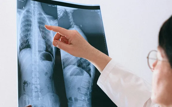 Médica analisando uma radiografia da coluna