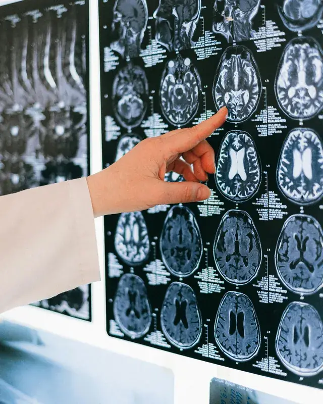 Médicos analisando exames de imagem do cérebro