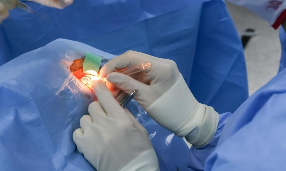 Cirurgia para Doença de Parkinson: conheça o marca-passo cerebral