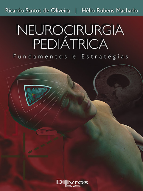 Neurocirurgia Pediátrica: Fundamentos e Estratégias